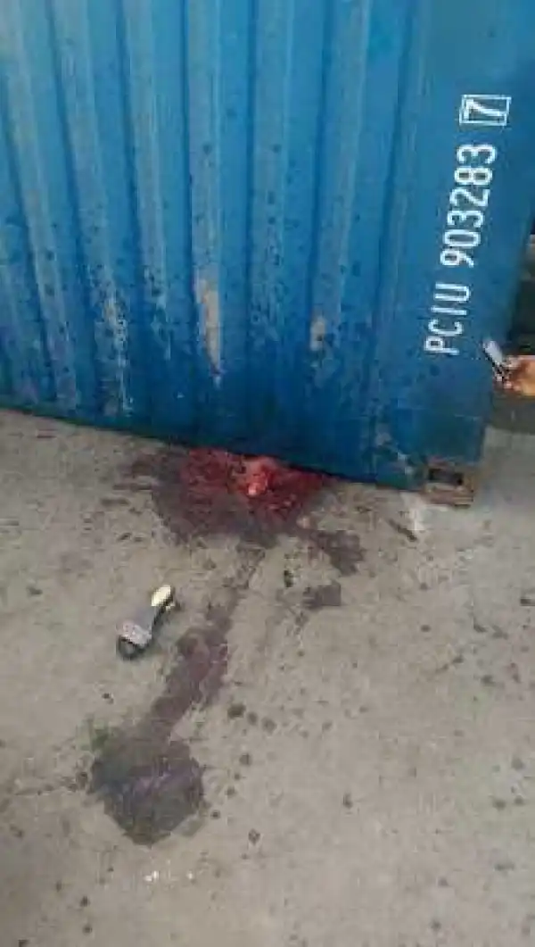 Exclusive pics: Lady dies after rescuers cut off her legs trapped under a trailer following horrific accident